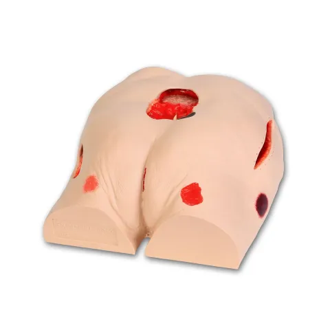Simulateur de traitement des escarres
