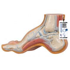 Pied Creux (Pes Cavus) - 3B Scientific