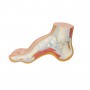 Pied Creux (Pes Cavus) 