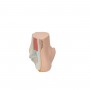 Pied Plat (Pes Planus) 