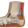 Pied Plat (Pes Planus) 