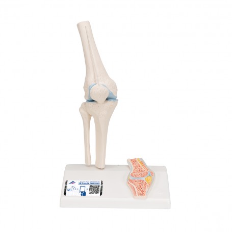 Mini-articulation du genou avec coupe transversale 