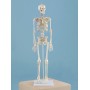 Squelette Daniel Erler Zimmer chez Toomedical