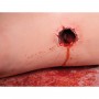 Jambe de  contrôle des hémorragies P103