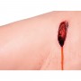 Jambe de  contrôle des hémorragies P103