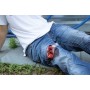 Moulage de contrôle des hémorragies