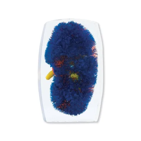 Modèle des vaisseaux rénaux (rouge-jaune-bleu)