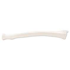 Radius, droite 
