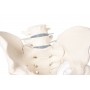 Bassin d homme avec sacrum, 2 vertèbres lombaires et cuisse - Erler Zimmer