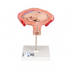 Foetus à 4 mois, décubitus ventral