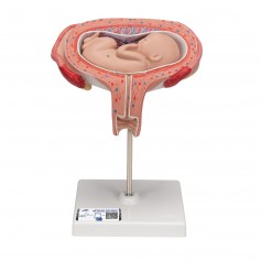 Foetus à 5 mois, décubitus dorsal