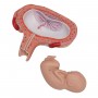 Foetus à 5 mois, décubitus dorsal 