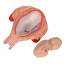Foetus à 5 mois, présentation du siège 
