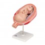 Foetus à 7 mois, position normale 