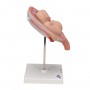Foetus jumeaux à 5 mois, position normale 