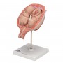 Foetus jumeaux à 5 mois, position normale 