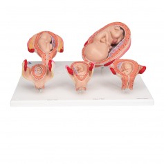 Série de grossesse 3B Scientific®, 5 modèles
