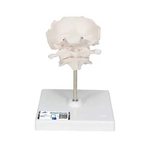Atlas et axis avec squame occipitale assemblés, sans socle