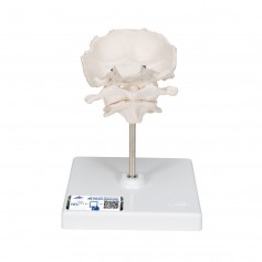 Atlas et axis avec squame occipitale assemblés, sans socle 