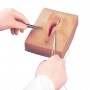 Suture post-épisiotomie, 3 pièces 