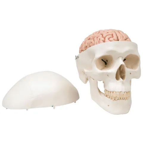 Crâne avec cerveau, en 8 parties