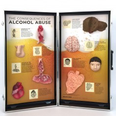 Les conséquences de l'alcoolisme panneau 3D