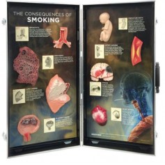 Les conséquences du tabagisme panneau 3D