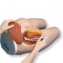 Fessier d'injection I.M. 