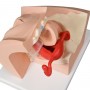 Modèle gynécologique d'explication aux patients - 3B Smart Anatomy