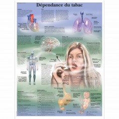 Planche anatomique Dépendance du tabac - 3B Scientific
