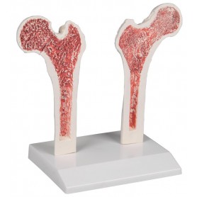 Chart Osteoporosis, 50x70cm