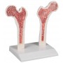 Chart Osteoporosis, 50x70cm