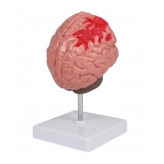 Pathologies du cerveau, taille de vie