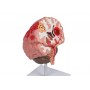 Pathologies du cerveau, taille de vie