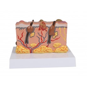 Modèle de peau pathologique