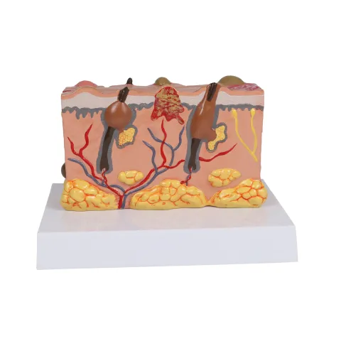 Modèle de peau pathologique