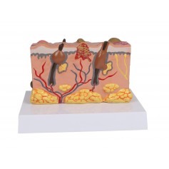 Modèle de peau pathologique