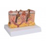 Modèle de peau pathologique