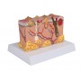 Modèle de peau pathologique