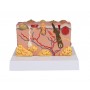 Modèle de peau pathologique
