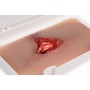Fracture ouverte, jambe avec fonction de saignement