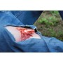Fracture ouverte, jambe avec fonction de saignement