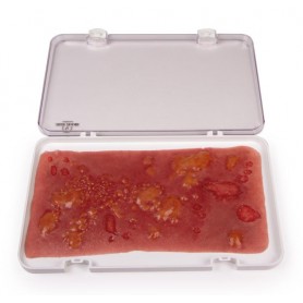 Peau brûlée au second degré, grande