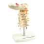 Modèle anatomie de colonne cervicale
