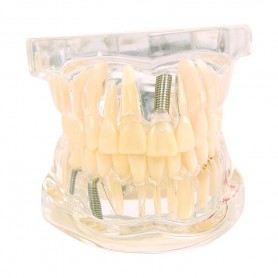 Modèle Transparent de la Mâchoire avec Dents Adultes