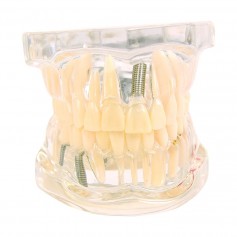 Modèle Transparent de la Mâchoire avec Dents Adultes