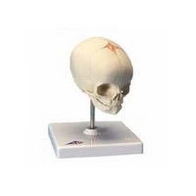Crâne de foetus, sur support 