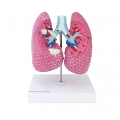Modèle pulmonaire avec maladies