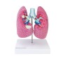 Modèle pulmonaire avec maladies