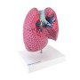 Modèle pulmonaire avec maladies